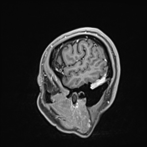 Click on the Serie image to view the images of VILLANUEVA, WILLIAM A.